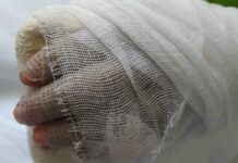 Ростовскому кондитеру во время приготовления теста отрубило кисть